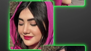 دکتر علی شعبانی - بهترین جراح بینی مازندران رفع چین و چروک
