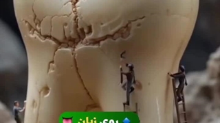 مسواک زدن چند درصد بر سلامت دندان تاثیر دارد