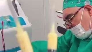 از بین بردن جای عمیق اسکار آکنه با استفاده از دستگاه های پزشکی آفرودیت و بایوفیلر