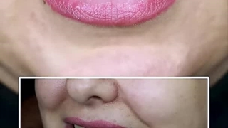 تجربه درمان کامپوزیت دندان در مجهزترین کلینیک تهرانپارس