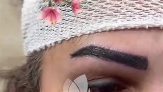 کاشت ابرو در کلینیک آوینا