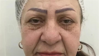 دکتر طاهره دلپذیر بوتاکس رادیوگرافی دندان