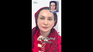 سوپر لیفت صورت و گردن برای پزشک مقیم سوئد