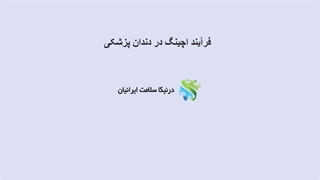 فرآیند اسید اچ در دندان پزشکی