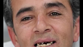 دکتر سینا دشتی زاده پریودنتیکس