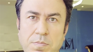 مهم ترین ها بعد کاشت ابرو