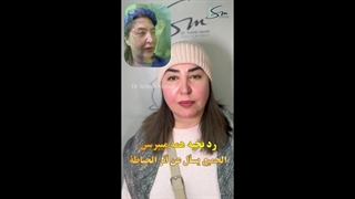 بعد 5 أشهر من جراحة شد الوجه والرقبة العمیقة