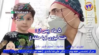 دکتر بلندی ختنه با لیزر