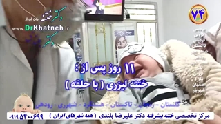 دکتر بلندی ختنه کرج