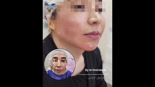 نمونه‌کارهای کلینیک دکتر خیرآبادی (6)