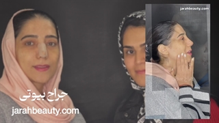 هزینه عمل بینی در مشهد
