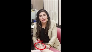 چند نکته برای تزریق فیلر به ساق و مچ پا