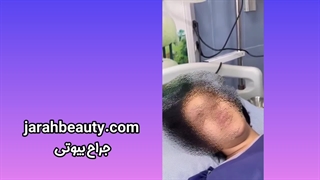 زایمان طبیعی در مشهد
