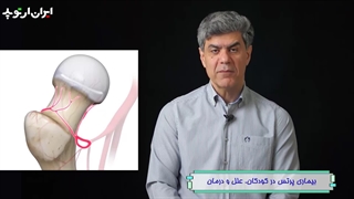 بیماری پرتس چیست