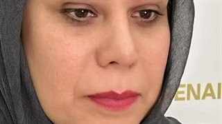 انجام کاشت ابرو بدون جراحی به روش sut در کلینیک رنسانس