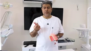 آموزش مسواک زدن صحیح - دکتر افشین میرزایی میکرونیدلینگ