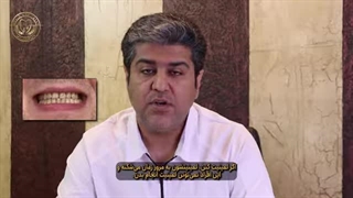 افرادی که هرگز نباید لمینت دندان انجام بدن!آیا شما هم جزوشون هستید؟