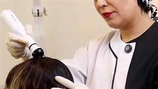 اسکراب اسکالپ و درمان ریزش مو