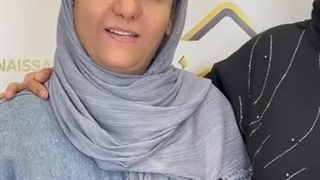 رضایت از کاشت ابروی طبیعی