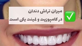 کامپوزیت و لمینت چقدر تراش می خورند