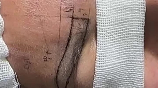 این ویدیو رو نبین اگه نمیخوای بدونی چجوری ابرو کاشته میشه