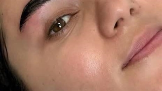 کاشت ابروی طبیعی بدون جراحی به روش انحصاری sut