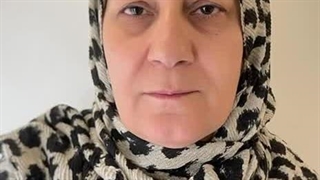 بلفاروپلاستی پلک با بخیه لیزری