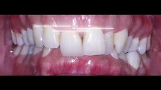 نمونه کار دکتر زینب افتخاری