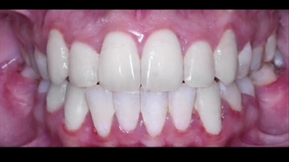 نمونه کارها