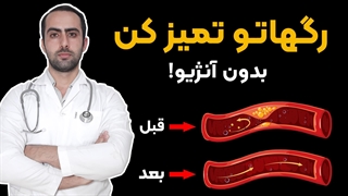 رگ هاتو تمیز کن بدون آنژیو !