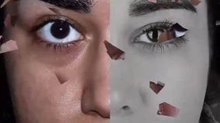 جراحی بینی توسط دکتر شهاب الدین عزیزی کلینیک زیبایی