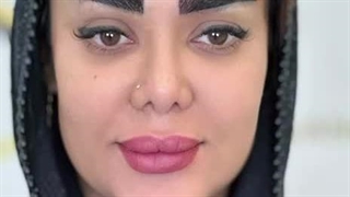 کاشت ابروی سوپر نچرال در کلینیک زیبایی رنسانس