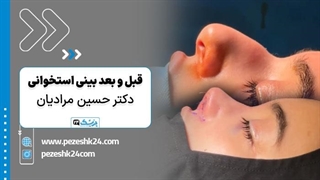 دکتر حسین مرادیان جراح بینی استخوانی در شیراز - پزشک 24