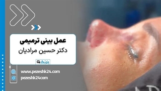 عمل بینی ترمیمی با دکتر حسین مرادیان در شیراز - پزشک 24 تزریق چربی
