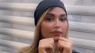 چالش غبغب در خانمها را برطرف کنیم -دکتر محمد یوسفوند