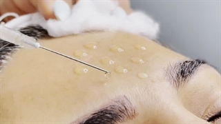 سمانه ابراهیمی پاکسازی پوست مشهد | سایت بهترین در مشهد