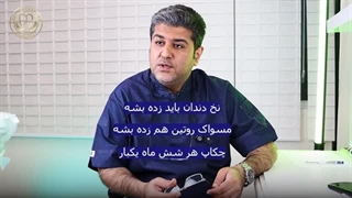 سوالات رایج در مورد لمینت دندان (پارت دوم)