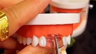 لبخندت ترک خورده؟ نگران نباش! فقط در چند دقیقه لبخندتو برگردون!