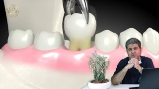 پودر استخوان چیست؟ بررسی انواع آن برای کاشت ایمپلنت