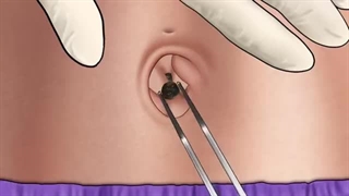 *Hamonium Asmr 2024*صاف کردن لاک ناخن و جرم گیری  دندان-قسمت یازدهم