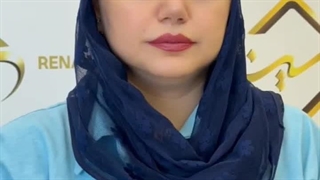 نتیجه کاشت ابرو بعد از 3 ماه