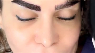 کاشت ابروی نچرال در کلینیک زیبایی رنسانس
