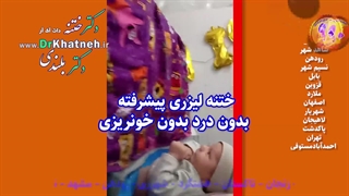 بهترین فیلم ختنه تهران کرج