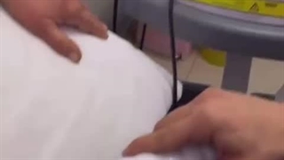 درمان التهابات دست با دستگاه پزشکی Plasma Surgical