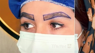 کاشت ابرو در کرج | ابروهای رویایی، فقط در یک جلسه