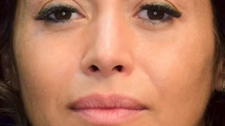 کاشت ابرو در کرج | زیبایی طبیعی با ابروهای پرپشت