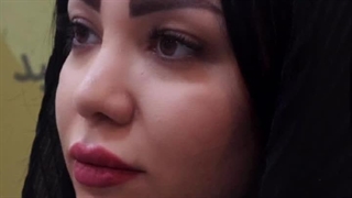 کاشت ابرو در کرج | زیبایی ابروها با کاشت حرفه‌ای و مدرن