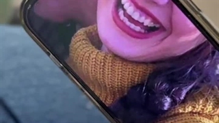 دکتر پریسا فکور اصلاح طرح لبخند