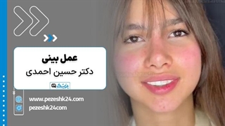 دکتر حسین احمدی جراح بینی در کرج - پزشک 24