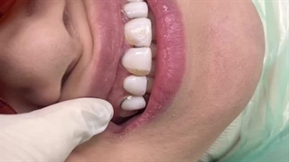 دکتر پریسا فکور دندانپزشکی کودکان